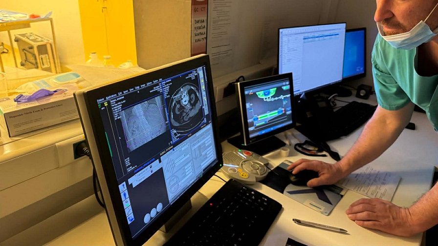 U Općoj bolnici Pula uveden postupak termalne ablacije tumora bubrega i jetre